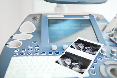 What to offer Scan Clinic clients to make their scan even more memorable